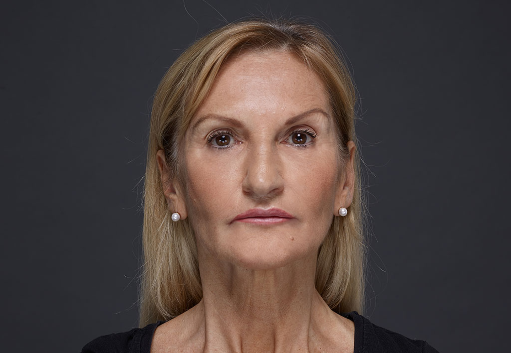 Blond woman face with brown eyes on grey background | Fillmed