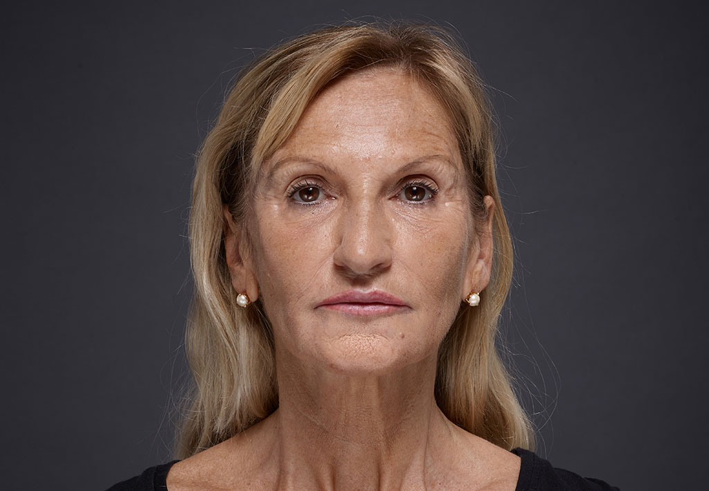 Blond woman face with brown eyes on grey background | Fillmed