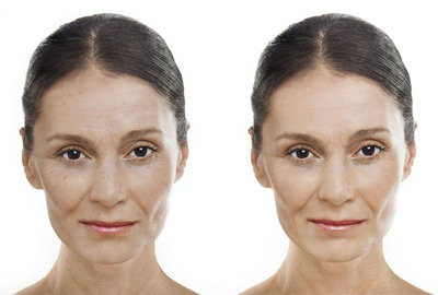 Before After woman face | Fillmed